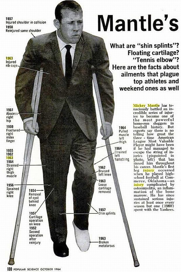 A graphic of Mickey Mantle’s injuries from:“Mantle's Breaks—and Yours,” Popular Science, October 1964, pp.100-103.